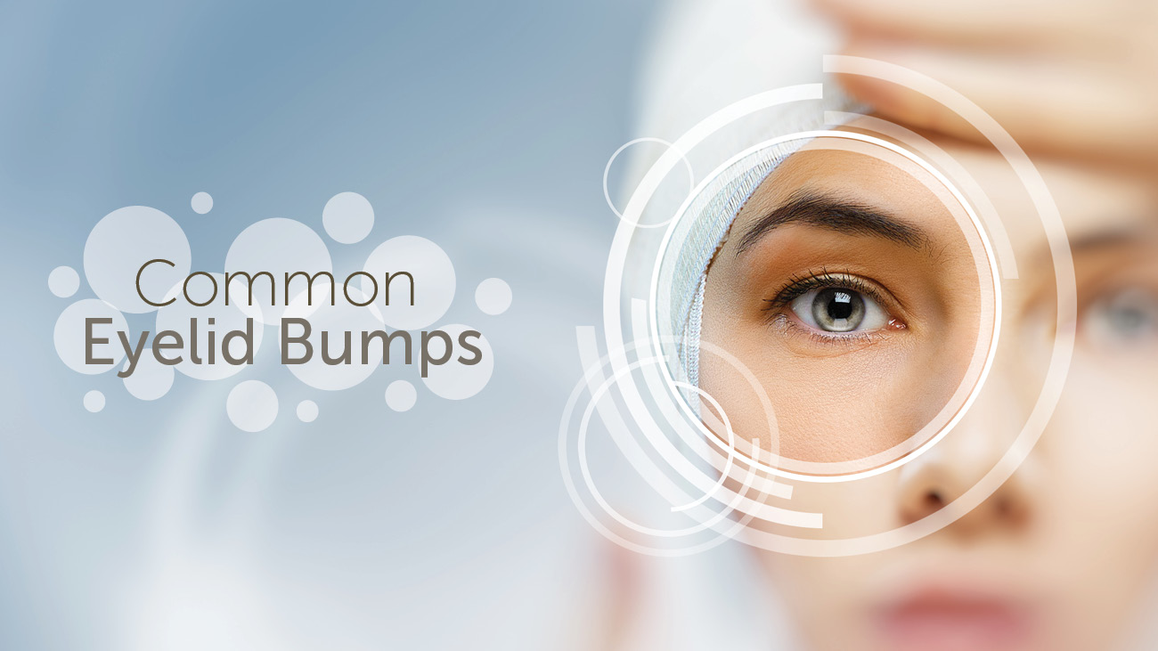 Little white bump discount on eyelid